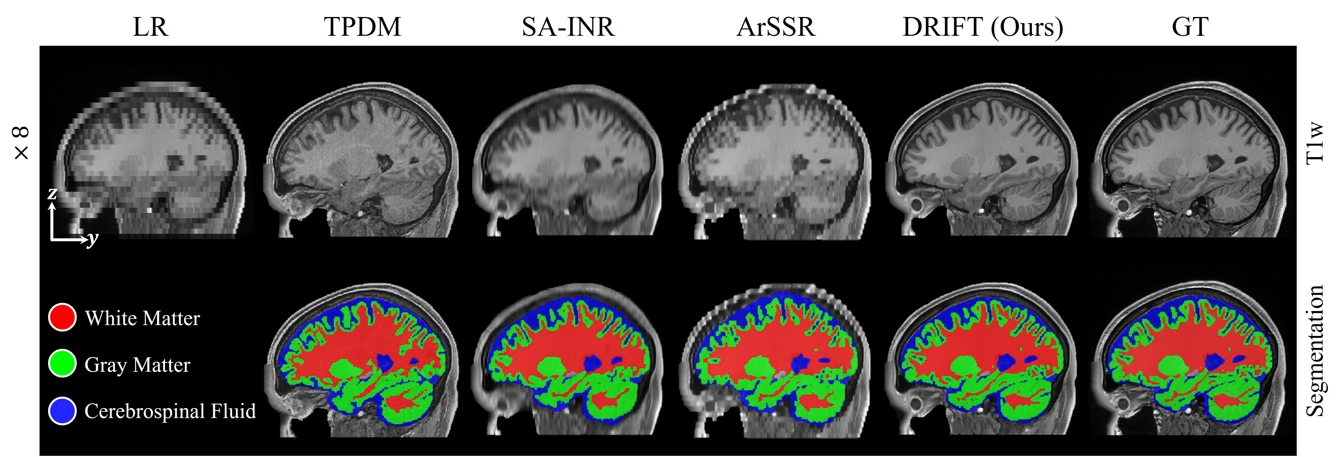Downstream SynthSeg segmentation comparison on HCP x8