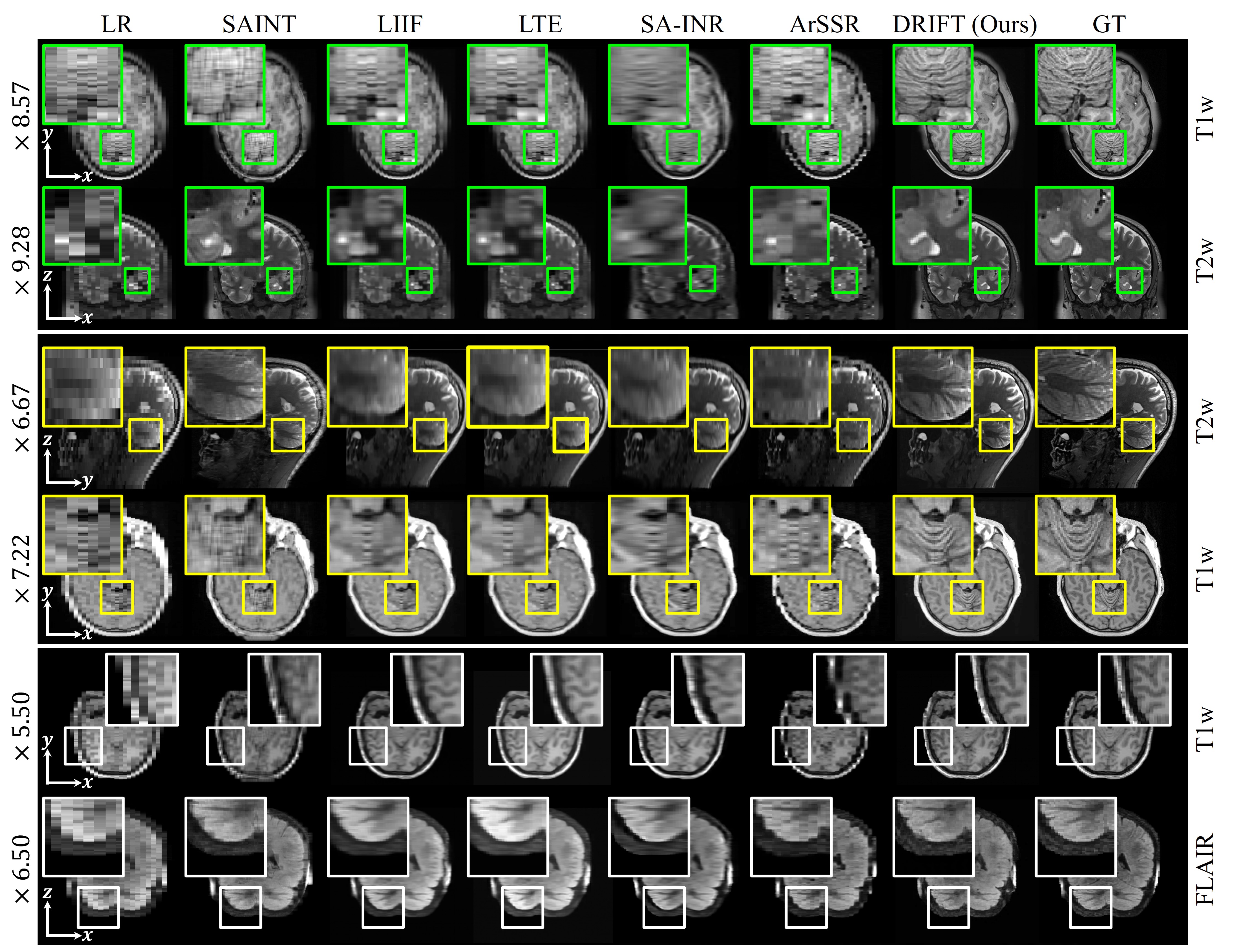 Arbitrary-scale qualitative comparison