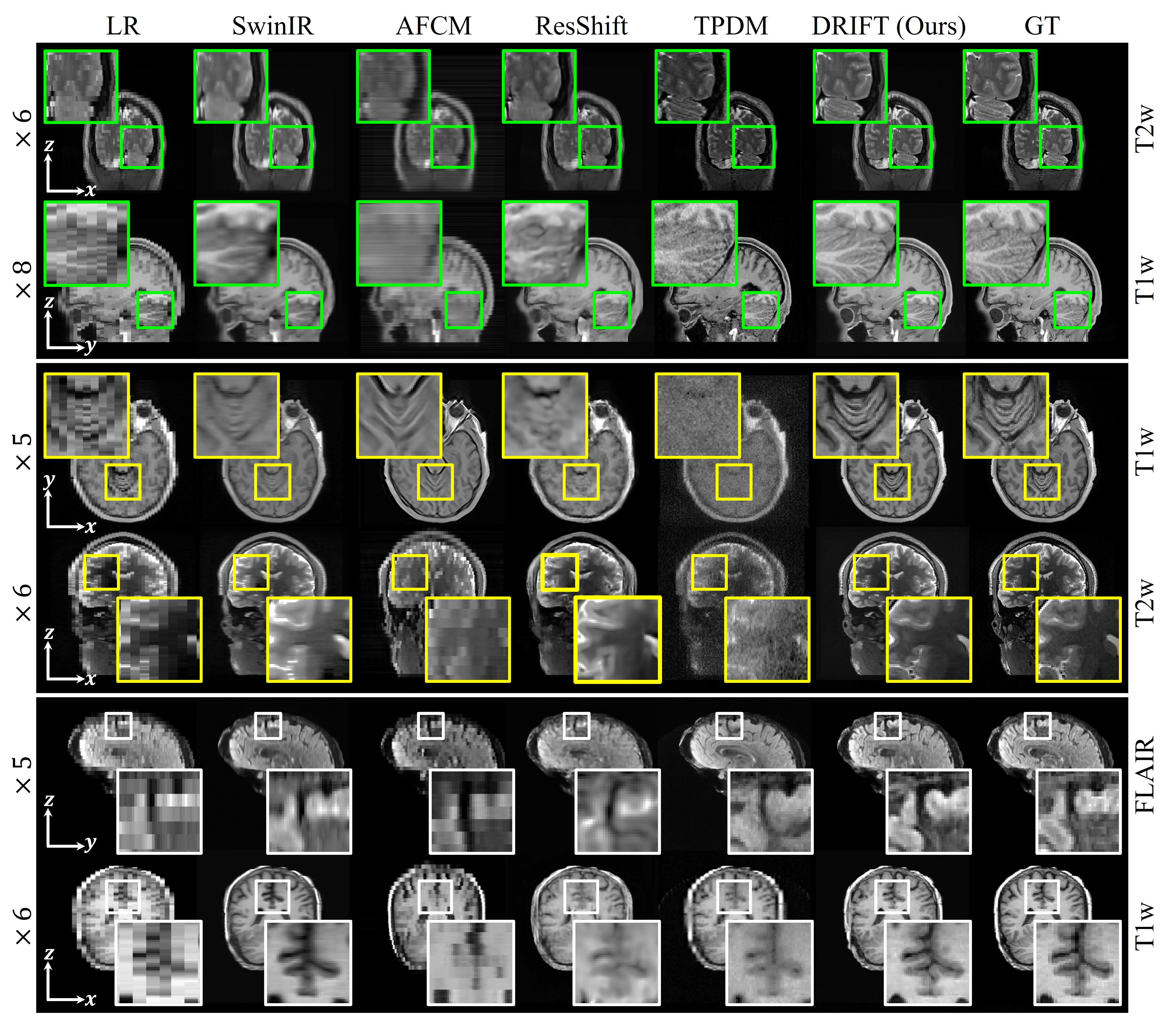 Fixed-scale qualitative comparison on HCP, MIND, IDEAS