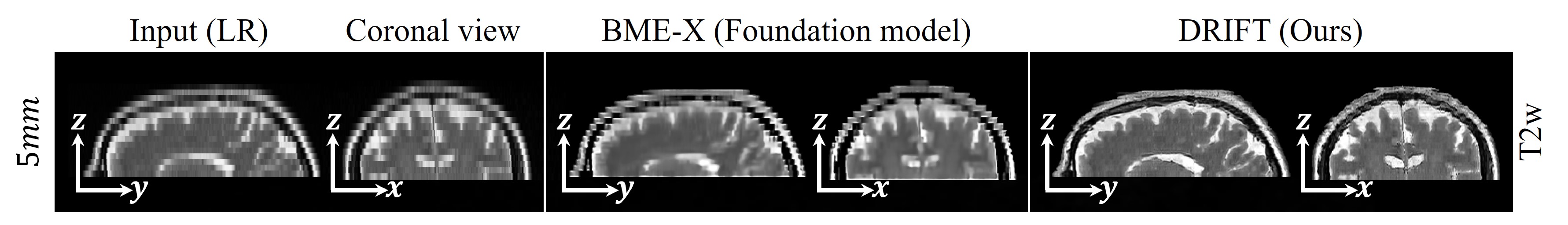Zero-shot comparison on fastMRI vs BME-X foundation model