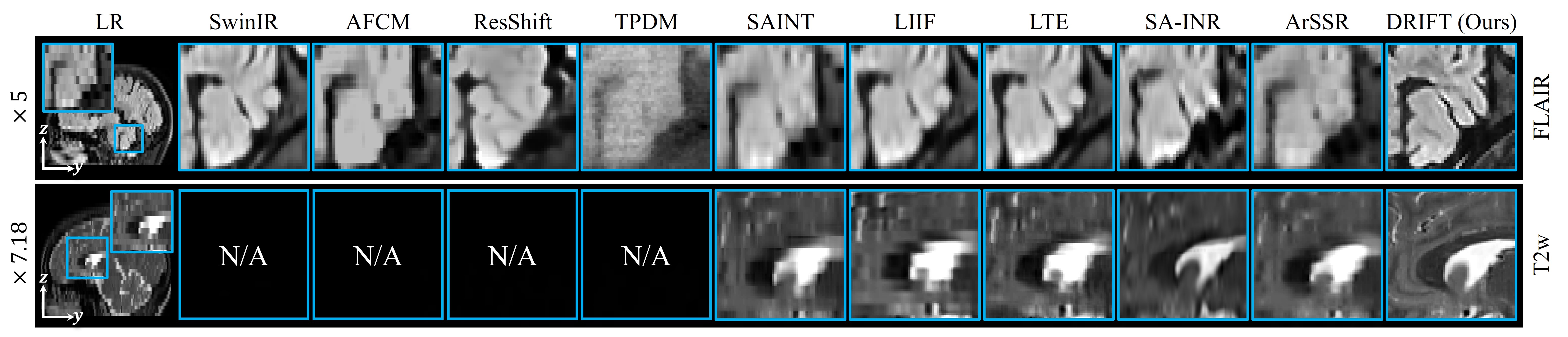 Zero-shot reconstruction on in-house clinical scans